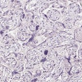 Anti-CYP11B1 antibody produced in rabbit Prestige Antibodies&#174; Powered by Atlas Antibodies, affinity isolated antibody, buffered aqueous glycerol solution