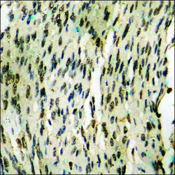 Anti-phospho-NF-kappaB p105/p50 (pSer907) antibody produced in rabbit affinity isolated antibody