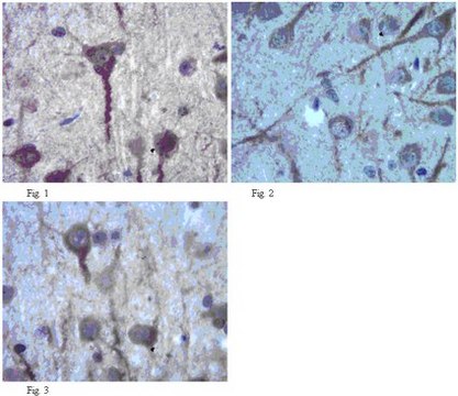 Anti-Neurexin-1-alpha Antibody from rabbit, purified by affinity chromatography