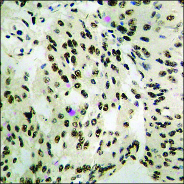 Anti-phospho-MEF2A (pThr312) antibody produced in rabbit affinity isolated antibody