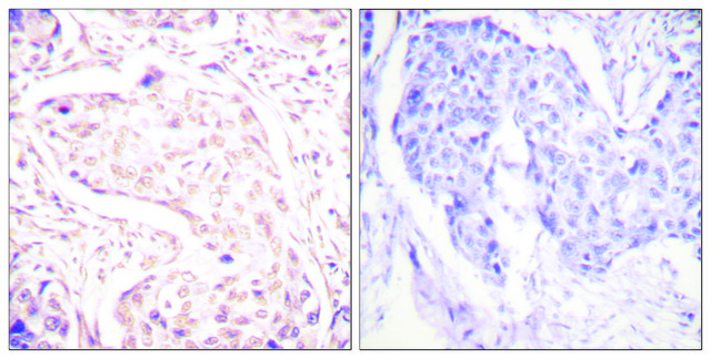 Anti-FOS antibody produced in rabbit affinity isolated antibody