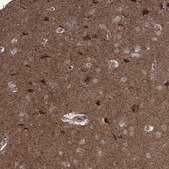 Anti-MAPK8IP2 antibody produced in rabbit Prestige Antibodies&#174; Powered by Atlas Antibodies, affinity isolated antibody, buffered aqueous glycerol solution