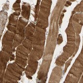Anti-ADAM17 antibody produced in rabbit Prestige Antibodies&#174; Powered by Atlas Antibodies, affinity isolated antibody, buffered aqueous glycerol solution