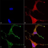 Monoclonal Anti-CACNB2 antibody produced in mouse clone S8B-1, 1&#160;mg/mL, purified immunoglobulin