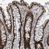 Anti-KLF3 antibody produced in rabbit Prestige Antibodies&#174; Powered by Atlas Antibodies, affinity isolated antibody, buffered aqueous glycerol solution