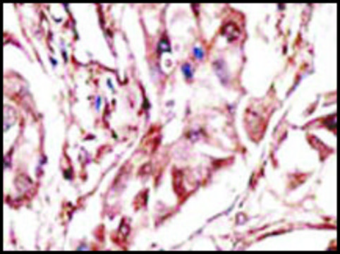 Anti-DKK2 (C-term) antibody produced in rabbit IgG fraction of antiserum, buffered aqueous solution