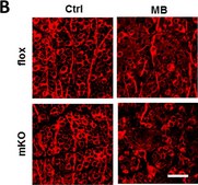 Anti-Tubulin &#946; III Antibody Chemicon&#174;, from mouse