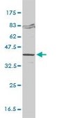 Monoclonal Anti-FVT1 antibody produced in mouse clone 2B2-3C11, purified immunoglobulin, buffered aqueous solution