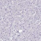 Anti-HSD11B2 antibody produced in rabbit Prestige Antibodies&#174; Powered by Atlas Antibodies, affinity isolated antibody, buffered aqueous glycerol solution