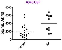 SMC&#174; Amyloid Beta 1-40 High Sensitivity Immunoassay Kit