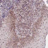 Anti-PUS10 antibody produced in rabbit Prestige Antibodies&#174; Powered by Atlas Antibodies, affinity isolated antibody, buffered aqueous glycerol solution