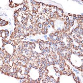 Anti-GABA transaminase (ABAT) Antibody, clone 10V1K9, Rabbit Monoclonal