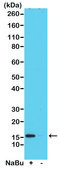 Anti-Acetyl-Histone H2A.Z (Lys4) antibody, Rabbit monoclonal recombinant, expressed in HEK 293 cells, clone RM221, purified immunoglobulin