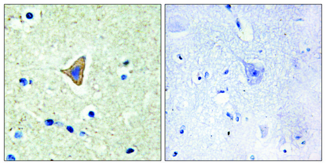Anti-CDH20 antibody produced in rabbit affinity isolated antibody