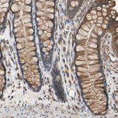 Anti-POR antibody produced in rabbit Prestige Antibodies&#174; Powered by Atlas Antibodies, affinity isolated antibody, buffered aqueous glycerol solution