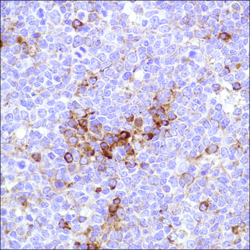 Anti-VPAC1 antibody, Rabbit monoclonal clone SP234, recombinant, expressed in proprietary host, affinity isolated antibody