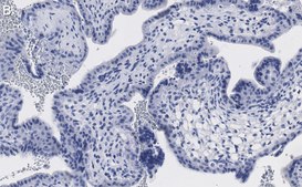 Anti-Keratin 7 Antibody, clone 3O4 ZooMAb&#174; Rabbit Monoclonal recombinant, expressed in HEK 293 cells