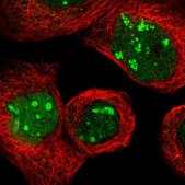 Anti-NOP58 antibody produced in rabbit Prestige Antibodies&#174; Powered by Atlas Antibodies, affinity isolated antibody, buffered aqueous glycerol solution