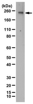 Anti-KDR/Flk-1/VEGFR2 Antibody from rabbit, purified by affinity chromatography