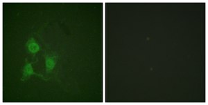Anti-phospho-PKA &#945;/&#946; CAT (pThr197) antibody produced in rabbit affinity isolated antibody