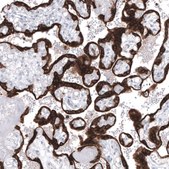 Monoclonal Anti-BCL2 antibody produced in mouse Prestige Antibodies&#174; Powered by Atlas Antibodies, clone CL7935, purified immunoglobulin, buffered aqueous glycerol solution