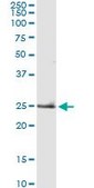 Monoclonal Anti-TNF antibody produced in mouse clone M1-C4, purified immunoglobulin, buffered aqueous solution