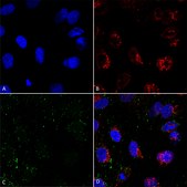 Monoclonal Anti-HSP70 antibody produced in mouse clone 1H11