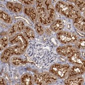 Anti-STX3 antibody produced in rabbit Prestige Antibodies&#174; Powered by Atlas Antibodies, affinity isolated antibody, buffered aqueous glycerol solution
