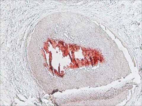 Anti-Histone Deacetylase 5 (HDAC5) (NA-16) antibody produced in rabbit affinity isolated antibody, buffered aqueous solution