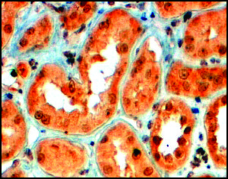 Anti-SEMA5A antibody produced in goat affinity isolated antibody, buffered aqueous solution