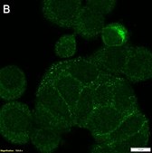 Anti-MMP-7 Antibody, clone 2B3 ZooMAb&#174; Rabbit Monoclonal recombinant, expressed in HEK 293 cells