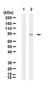 Anti-p-PKC&#946; (Ser660) Antibody, clone 2C11 ZooMAb&#174; Rabbit Monoclonal recombinant, expressed in HEK 293 cells