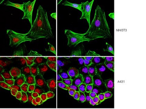 Anti-RING1 Antibody, clone 4D6 clone 4D6, from mouse