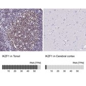Anti-IKZF1 antibody produced in rabbit Prestige Antibodies&#174; Powered by Atlas Antibodies, affinity isolated antibody, buffered aqueous glycerol solution