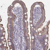 Anti-SSTR1 antibody produced in rabbit Prestige Antibodies&#174; Powered by Atlas Antibodies, affinity isolated antibody, buffered aqueous glycerol solution