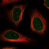 Anti-AAAS antibody produced in rabbit Prestige Antibodies&#174; Powered by Atlas Antibodies, affinity isolated antibody, buffered aqueous glycerol solution