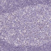 Anti-LRRC26 antibody produced in rabbit Prestige Antibodies&#174; Powered by Atlas Antibodies, affinity isolated antibody, buffered aqueous glycerol solution
