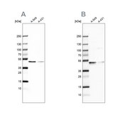 Anti-EPHX1 antibody produced in rabbit Prestige Antibodies&#174; Powered by Atlas Antibodies, affinity isolated antibody, buffered aqueous glycerol solution