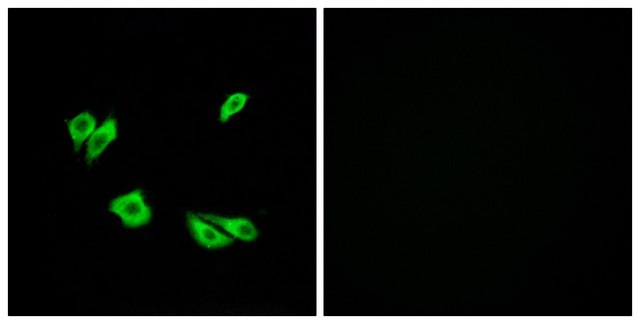 Anti-DAB1 antibody produced in rabbit affinity isolated antibody