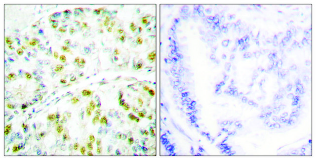 Anti-Ataxin 1, C-Terminal antibody produced in rabbit affinity isolated antibody