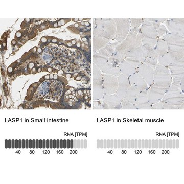Anti-LASP1 antibody produced in rabbit Prestige Antibodies&#174; Powered by Atlas Antibodies, affinity isolated antibody, buffered aqueous glycerol solution