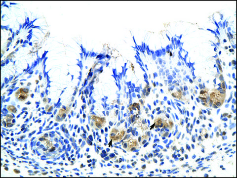 Anti-CSH1 antibody produced in rabbit IgG fraction of antiserum