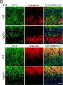 Anti-Calretinin Antibody, clone 6B8.2 clone 6B8.2, Chemicon&#174;, from mouse