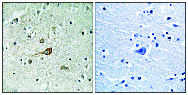 Anti-C-ABL antibody produced in rabbit affinity isolated antibody