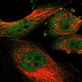 Anti-KLHL25 antibody produced in rabbit Prestige Antibodies&#174; Powered by Atlas Antibodies, affinity isolated antibody, buffered aqueous glycerol solution