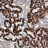 Anti-ACSF2 antibody produced in rabbit Prestige Antibodies&#174; Powered by Atlas Antibodies, affinity isolated antibody, buffered aqueous glycerol solution