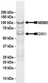 MDM2/CK1&#948; Protein, active, 10 &#181;g Active, full length, recombinant human MDM2 (N-terminal GST-tagged) combined in vitro with CK1&#948;, active (Item # 14-520). For use in Enzyme Assays. Functions as an E3 ligase in ubiquitination assays.