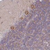 Anti-PRKCH antibody produced in rabbit Prestige Antibodies&#174; Powered by Atlas Antibodies, affinity isolated antibody, buffered aqueous glycerol solution