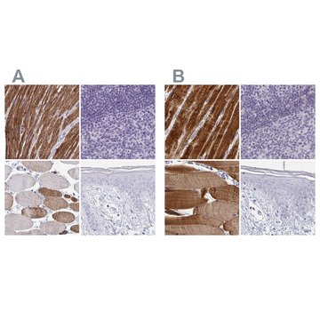 Anti-CASQ2 antibody produced in rabbit Prestige Antibodies&#174; Powered by Atlas Antibodies, affinity isolated antibody, buffered aqueous glycerol solution