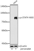 Anti-Phospho-STAT4-Y693 antibody produced in rabbit